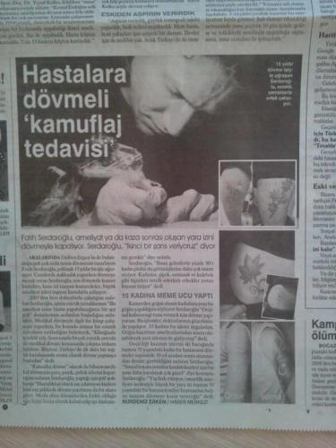 16_fatihserdaroglu_fatihserdaroglucom_hastalara kamuflaj dövme fatih serdaroğlu hürriyet gazetesi